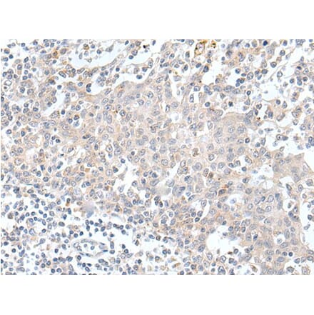 KCNH1 Antibody from Signalway Antibody (43927) - Antibodies.com