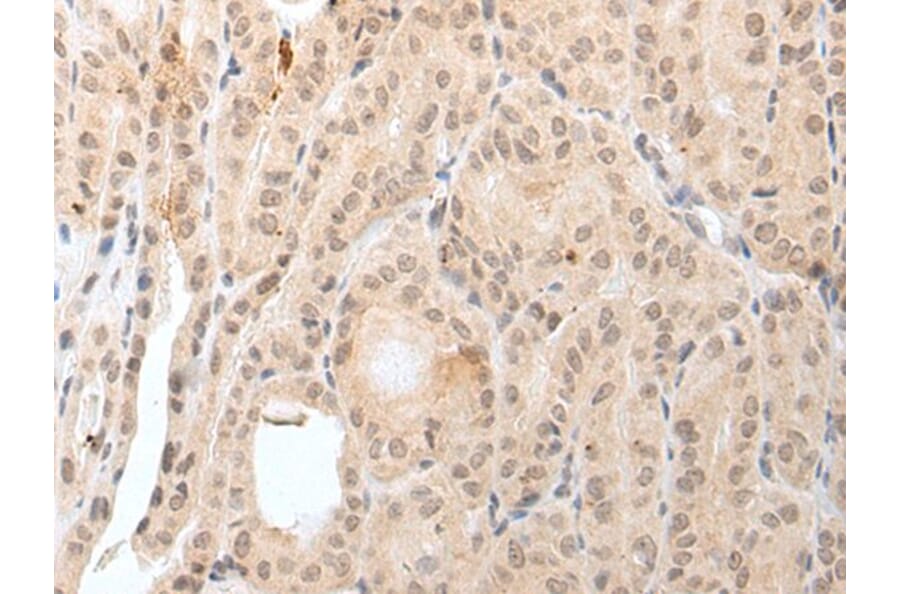 KCNH1 Antibody from Signalway Antibody (43927) - Antibodies.com