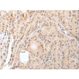 KCNH1 Antibody from Signalway Antibody (43927) - Antibodies.com