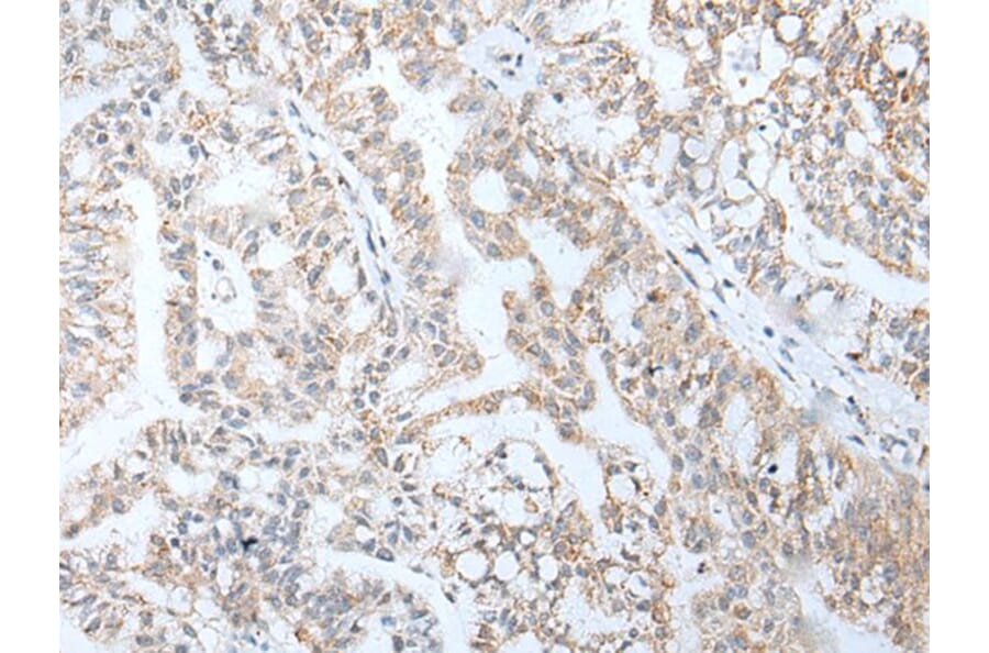 HOXA5 Antibody from Signalway Antibody (43929) - Antibodies.com