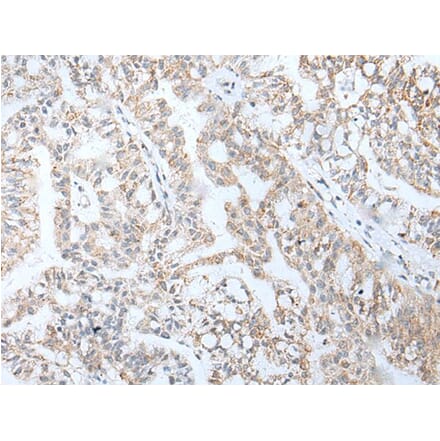 HOXA5 Antibody from Signalway Antibody (43929) - Antibodies.com