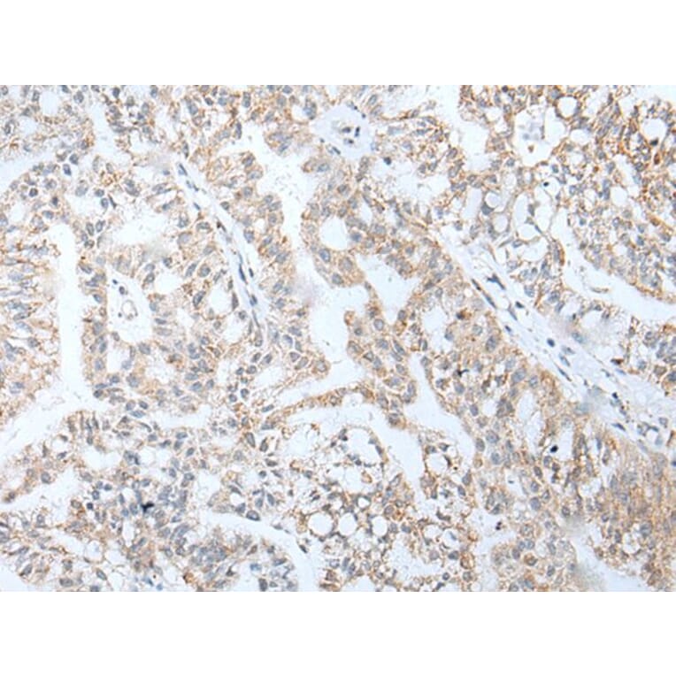 HOXA5 Antibody from Signalway Antibody (43929) - Antibodies.com