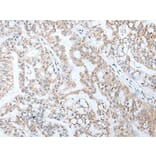 HOXA5 Antibody from Signalway Antibody (43929) - Antibodies.com