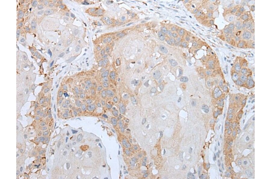 HOXA5 Antibody from Signalway Antibody (43929) - Antibodies.com