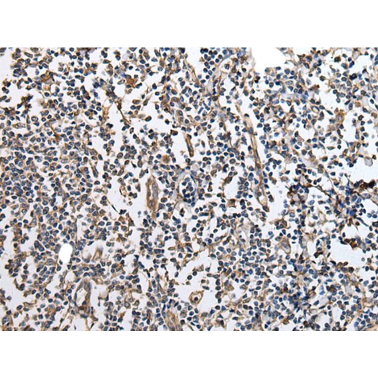 RPTOR Antibody from Signalway Antibody (43933) - Antibodies.com