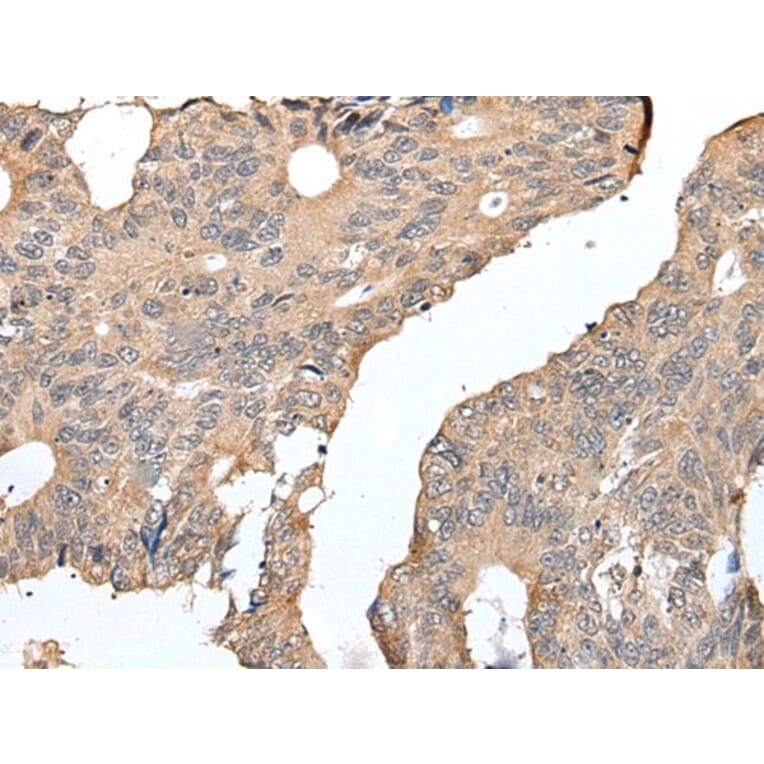 SEPW1 Antibody from Signalway Antibody (43935) - Antibodies.com