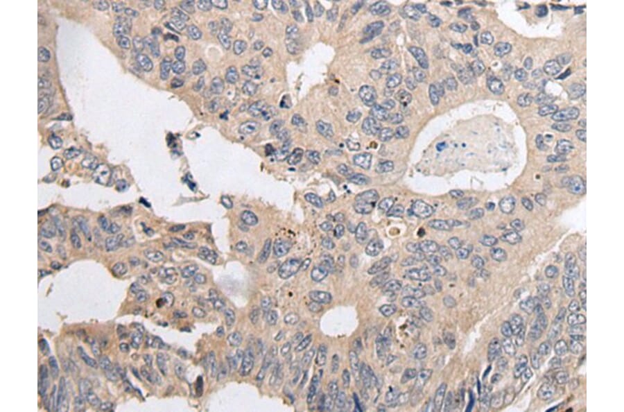 ARL5A Antibody from Signalway Antibody (43936) - Antibodies.com