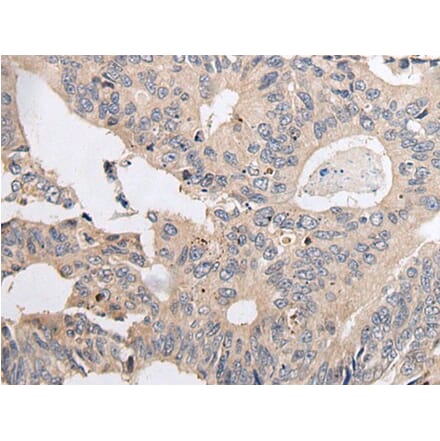 ARL5A Antibody from Signalway Antibody (43936) - Antibodies.com