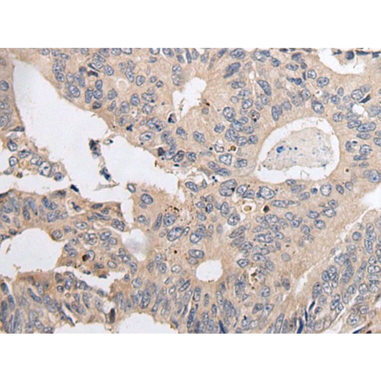 ARL5A Antibody from Signalway Antibody (43936) - Antibodies.com