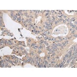 ARL5A Antibody from Signalway Antibody (43936) - Antibodies.com