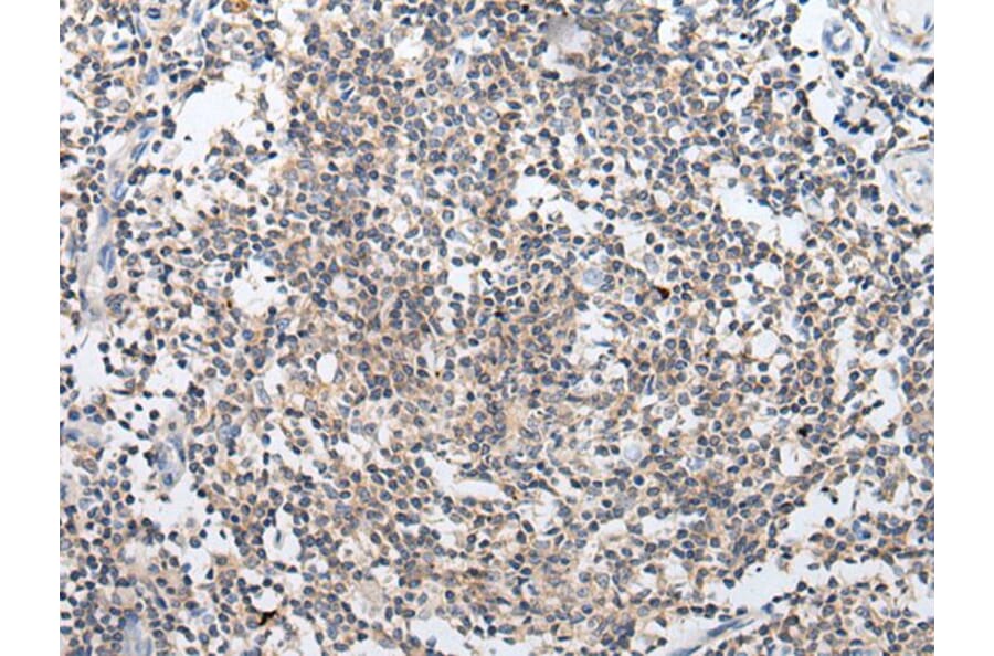 ARL5A Antibody from Signalway Antibody (43936) - Antibodies.com