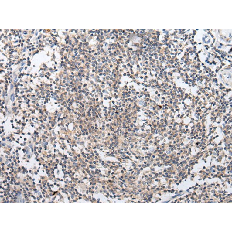 ARL5A Antibody from Signalway Antibody (43936) - Antibodies.com