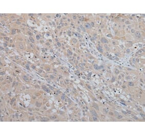 MLANA Antibody from Signalway Antibody (43951) - Antibodies.com