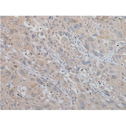 MLANA Antibody from Signalway Antibody (43951) - Antibodies.com