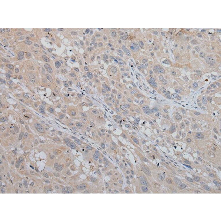 MLANA Antibody from Signalway Antibody (43951) - Antibodies.com