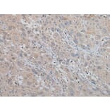 MLANA Antibody from Signalway Antibody (43951) - Antibodies.com