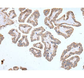 ABCD1 Antibody from Signalway Antibody (43954) - Antibodies.com