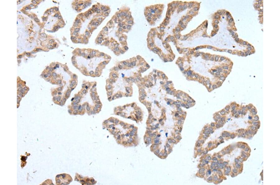 ABCD1 Antibody from Signalway Antibody (43954) - Antibodies.com
