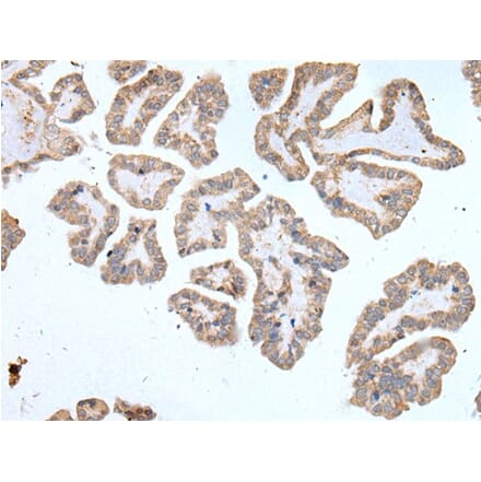 ABCD1 Antibody from Signalway Antibody (43954) - Antibodies.com