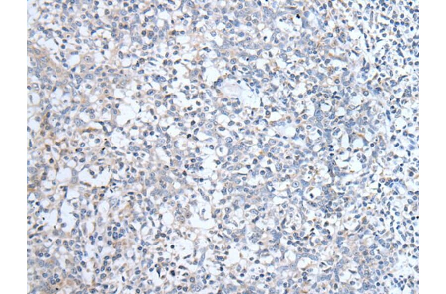 ABCD1 Antibody from Signalway Antibody (43954) - Antibodies.com