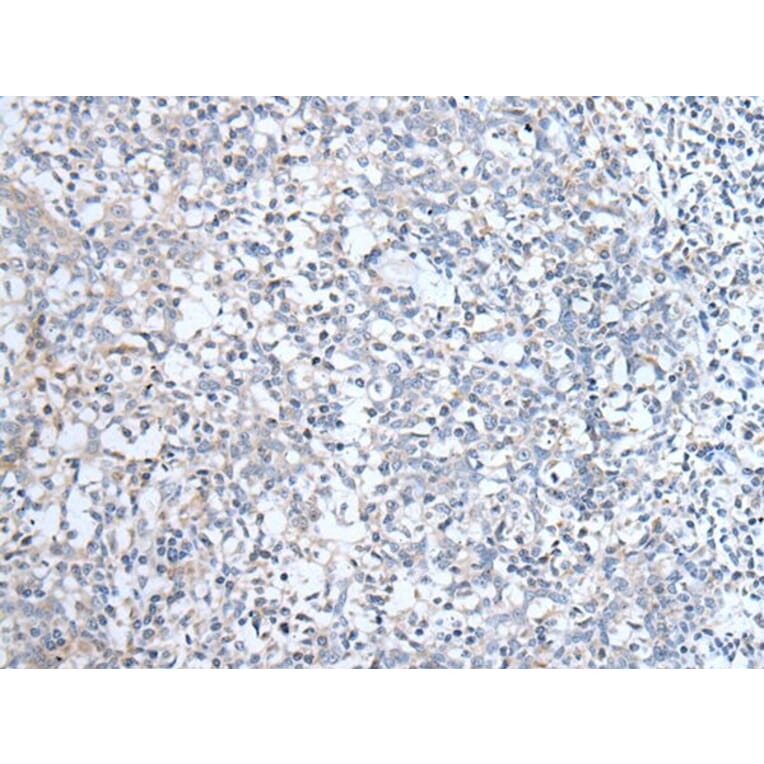 ABCD1 Antibody from Signalway Antibody (43954) - Antibodies.com