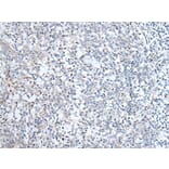 ABCD1 Antibody from Signalway Antibody (43954) - Antibodies.com