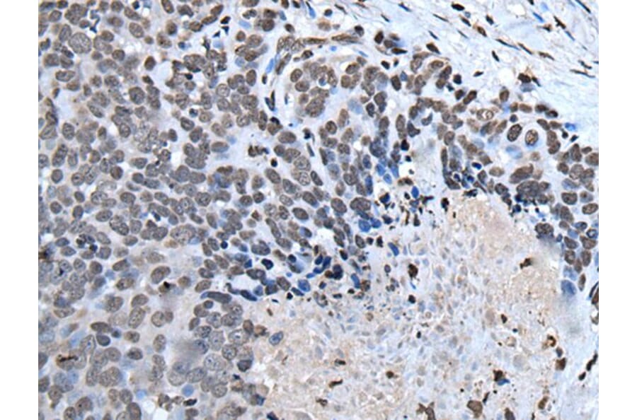 HOXD1 Antibody from Signalway Antibody (43955) - Antibodies.com