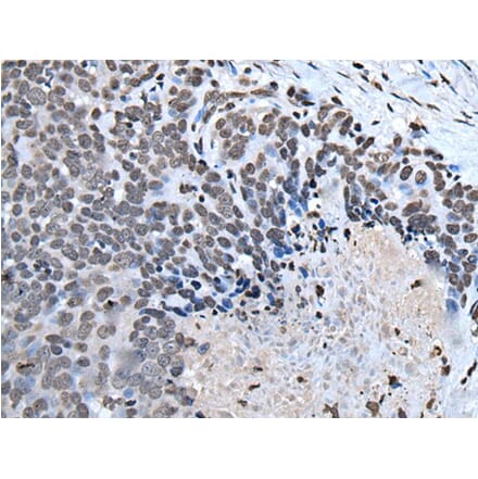 HOXD1 Antibody from Signalway Antibody (43955) - Antibodies.com