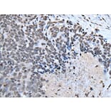 HOXD1 Antibody from Signalway Antibody (43955) - Antibodies.com