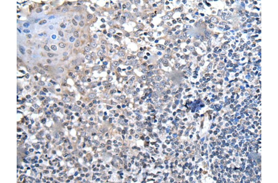 HOXD1 Antibody from Signalway Antibody (43955) - Antibodies.com