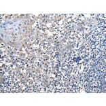 HOXD1 Antibody from Signalway Antibody (43955) - Antibodies.com