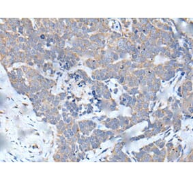 MATN2 Antibody from Signalway Antibody (43956) - Antibodies.com
