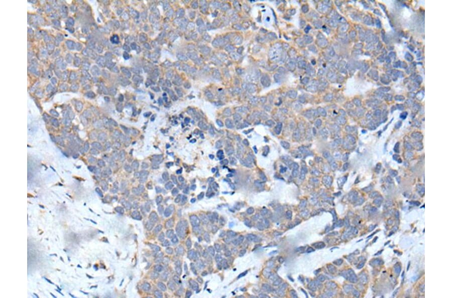 MATN2 Antibody from Signalway Antibody (43956) - Antibodies.com