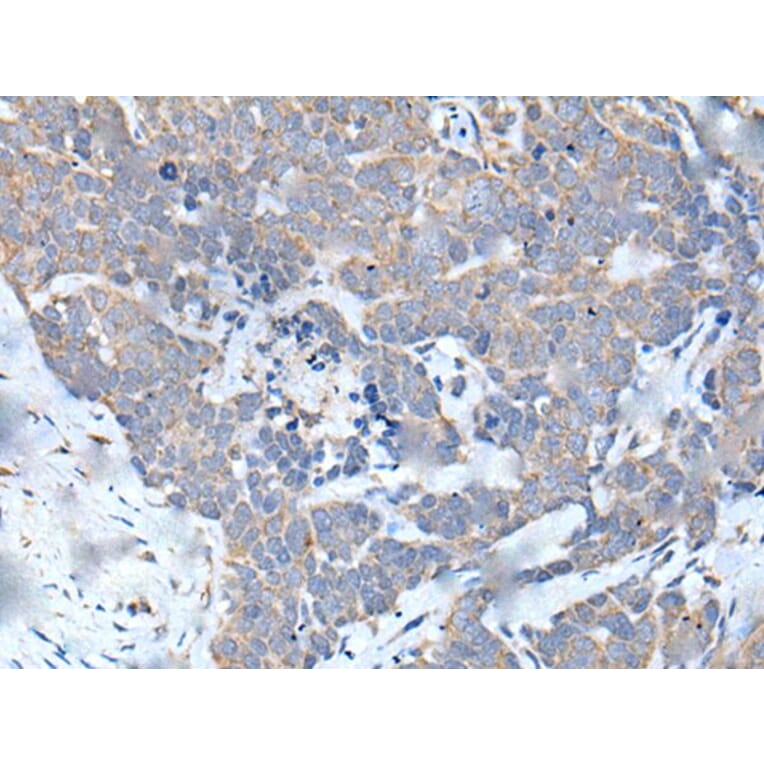 MATN2 Antibody from Signalway Antibody (43956) - Antibodies.com