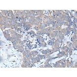 MATN2 Antibody from Signalway Antibody (43956) - Antibodies.com