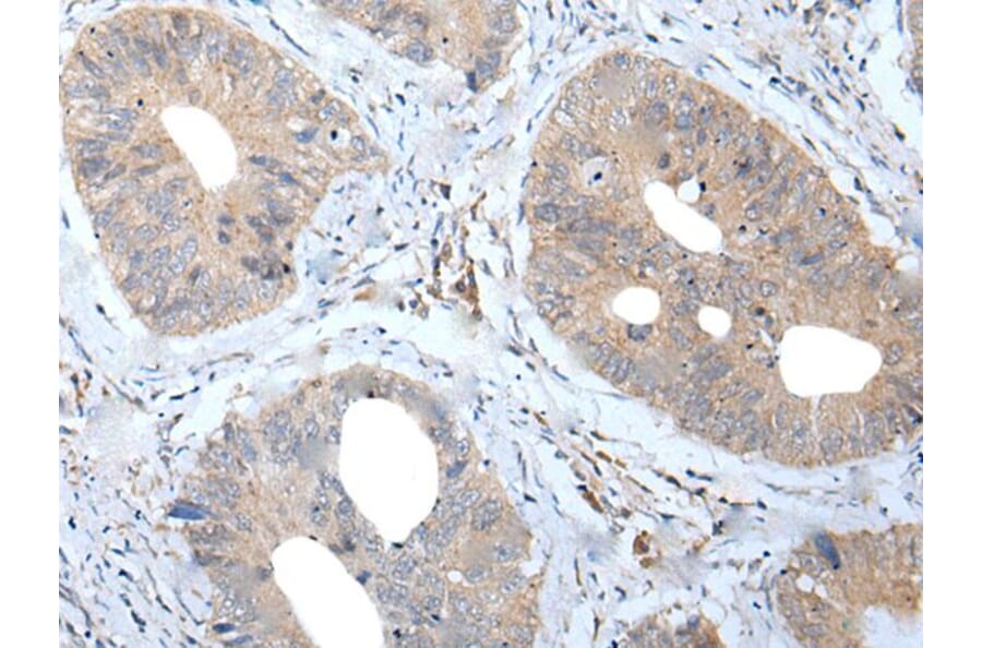 MATN2 Antibody from Signalway Antibody (43956) - Antibodies.com