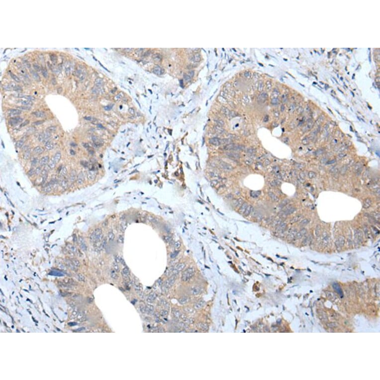 MATN2 Antibody from Signalway Antibody (43956) - Antibodies.com