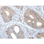 MATN2 Antibody from Signalway Antibody (43956) - Antibodies.com