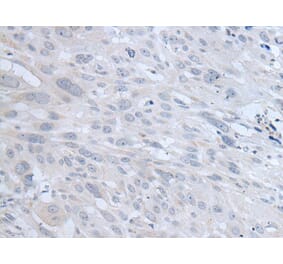 TYRP1 Antibody from Signalway Antibody (43958) - Antibodies.com