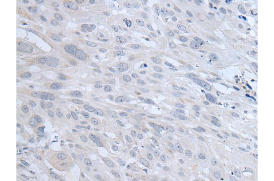 TYRP1 Antibody from Signalway Antibody (43958) - Antibodies.com