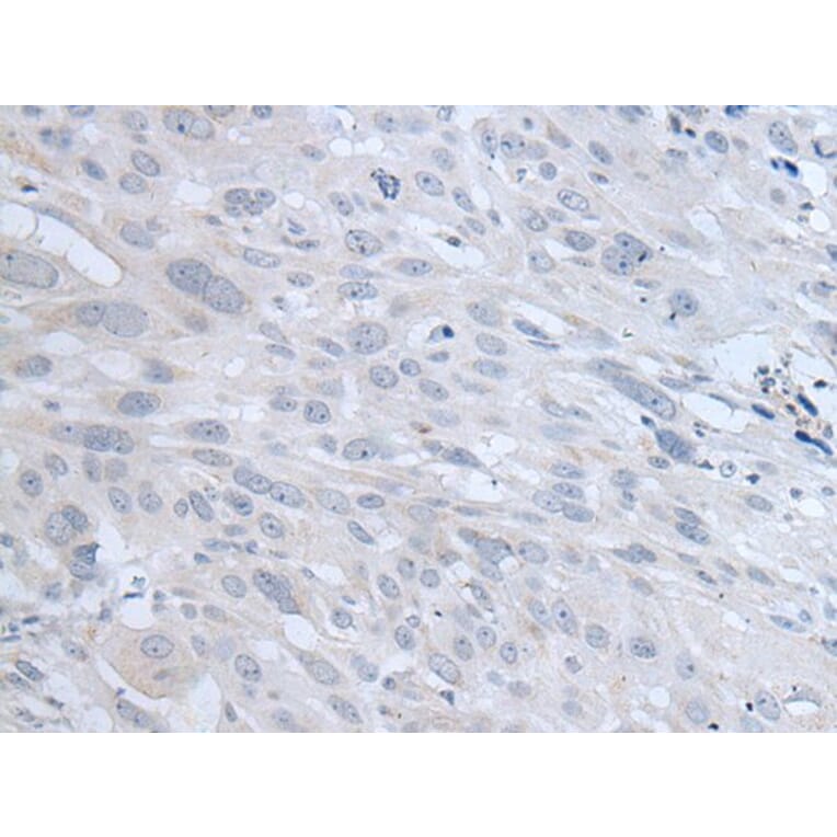 TYRP1 Antibody from Signalway Antibody (43958) - Antibodies.com