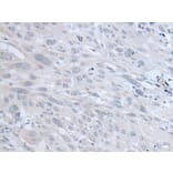 TYRP1 Antibody from Signalway Antibody (43958) - Antibodies.com