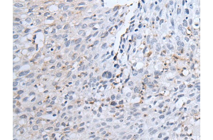 TYRP1 Antibody from Signalway Antibody (43958) - Antibodies.com