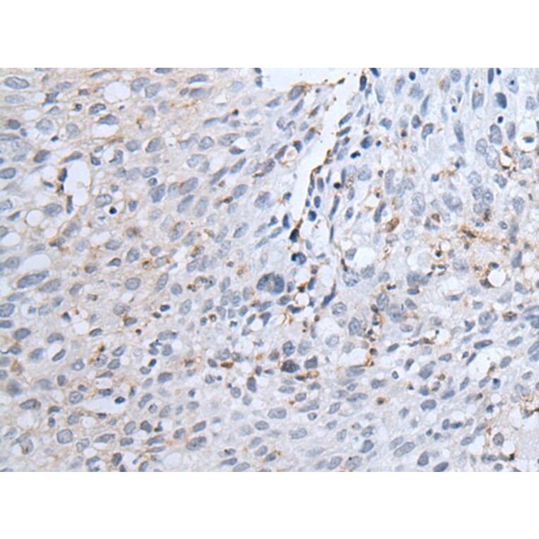 TYRP1 Antibody from Signalway Antibody (43958) - Antibodies.com
