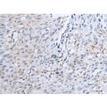 TYRP1 Antibody from Signalway Antibody (43958) - Antibodies.com