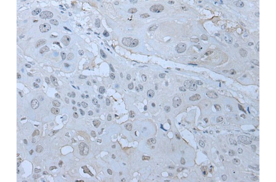 HUWE1 Antibody from Signalway Antibody (43961) - Antibodies.com