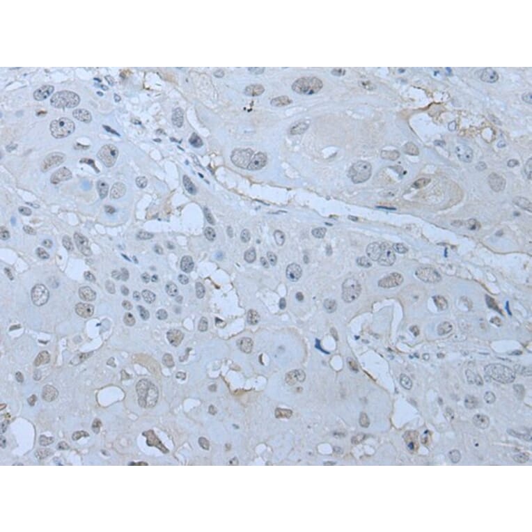 HUWE1 Antibody from Signalway Antibody (43961) - Antibodies.com