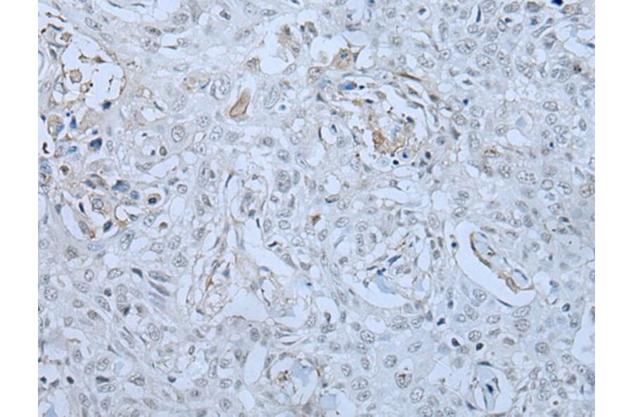 HUWE1 Antibody from Signalway Antibody (43961) - Antibodies.com