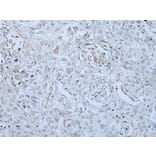 HUWE1 Antibody from Signalway Antibody (43961) - Antibodies.com