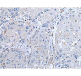 LTBP4 Antibody from Signalway Antibody (43963) - Antibodies.com